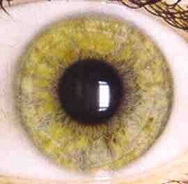Iridology photo